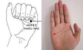 Giảm bớt tình trạng ốm nghén trong thai kỳ bằng day bấm huyệt