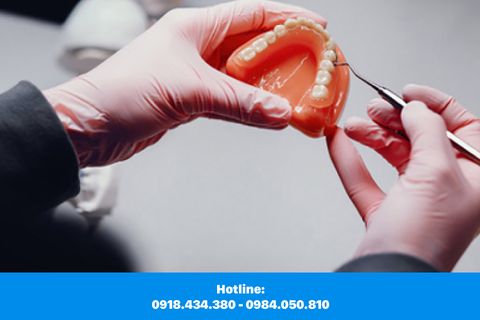 Bị Mất Răng Nên Trồng Răng Sứ Hay Cấy Ghép Răng IMPLANT