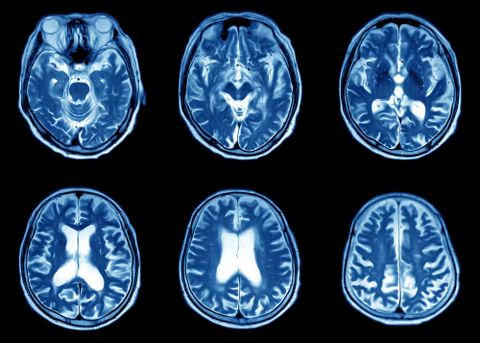 Sự khác nhau giữa chụp siêu âm, MRI và CT – Hiểu để chọn đúng