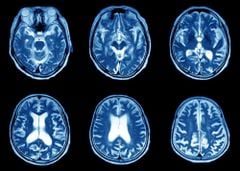 Sự khác nhau giữa chụp siêu âm, MRI và CT – Hiểu để chọn đúng