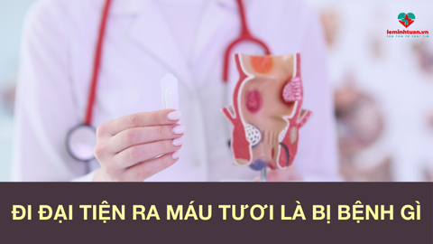Đi đại tiện ra máu tươi là bị bệnh gì? 5 cách điều trị tại nhà hiệu quả