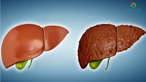 Men Gan Là Gì? Phân Biệt ALT, AST, GGT và Cách Kiểm Soát Hiệu Quả Với Infonic