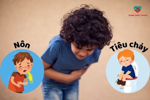 Trẻ em bị nôn và tiêu chảy nên ăn gì và không nên ăn gì?