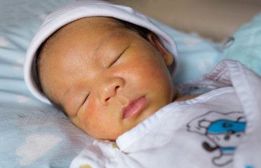 Vàng da ở trẻ sơ sinh có nguy hiểm không?