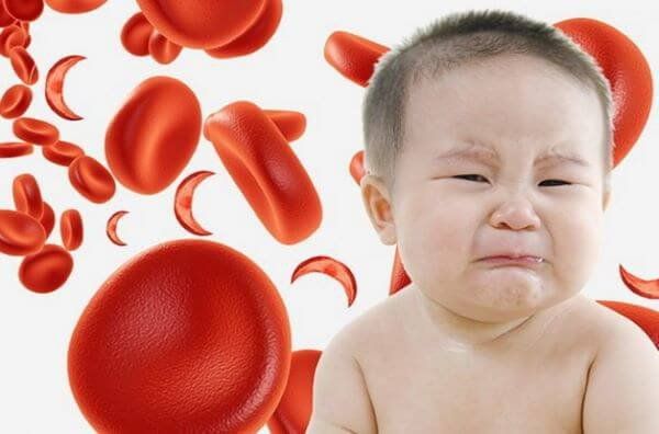 Để đưa ra được dinh dưỡng cho trẻ thiếu máu chúng ta tìm hiểu dấu hiệu của thiếu máu