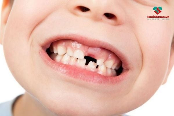 Trẻ thay răng cần bổ sung canxi như thế nào?