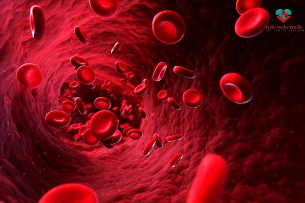 Thiếu máu do giảm số lượng hemoglobin trong cơ thể