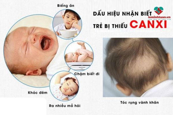 Trẻ thiếu canxi sẽ gây nên hậu quả gì