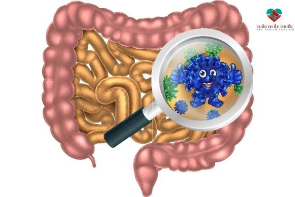 Loạn khuẩn đường tiêu hóa