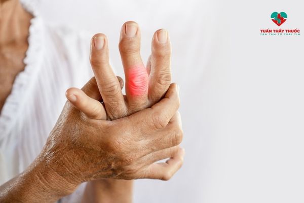 Một số nguyên nhân đau khớp ngón