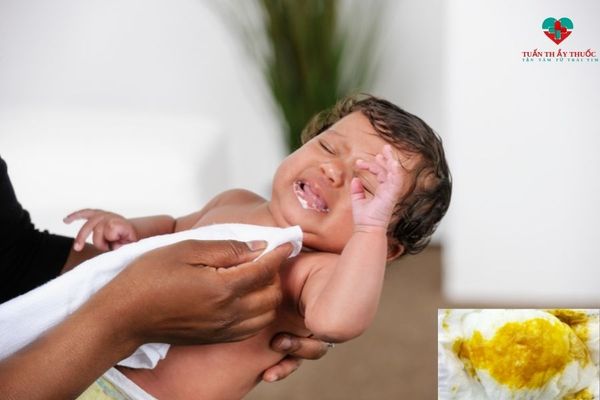 Phân trẻ sơ sinh bị tiêu chảy có đặc điểm gì?