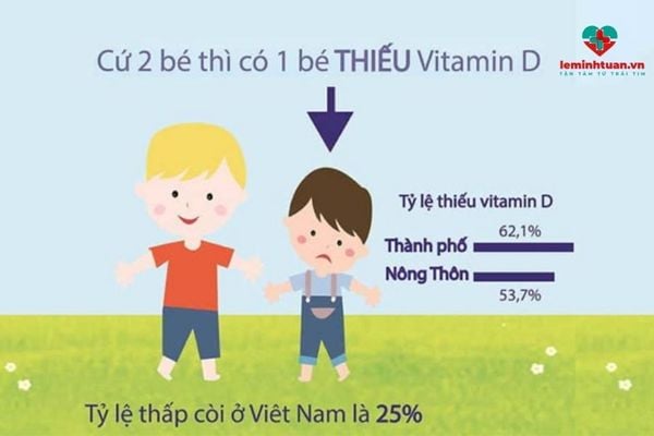 Trẻ thiếu vitamin D thường có nhiều dấu hiệu khác nhau