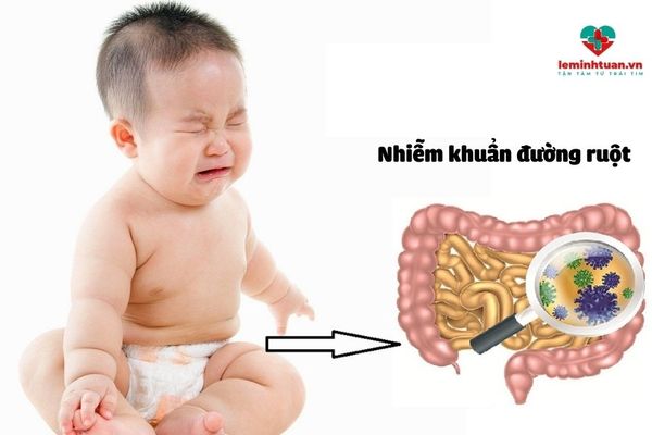 Nguyên nhân gây ra triệu chứng nhiễm khuẩn đường ruột ở trẻ em