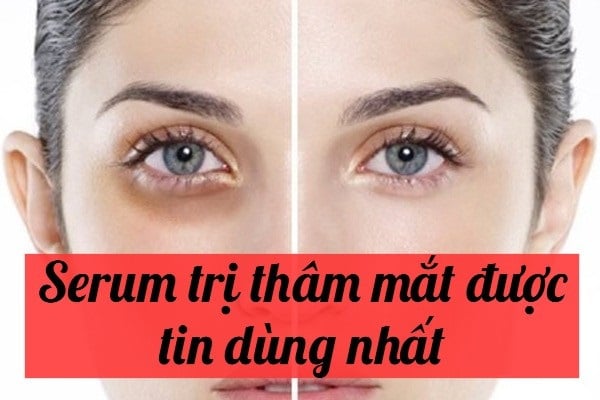 TOP 3 SERUM TRỊ THÂM QUẦNG MẮT HOT NHẤT NĂM 2023