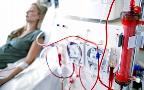 Lọc máu là gì? Các phương pháp lọc máu nào được sử dụng hiện nay?