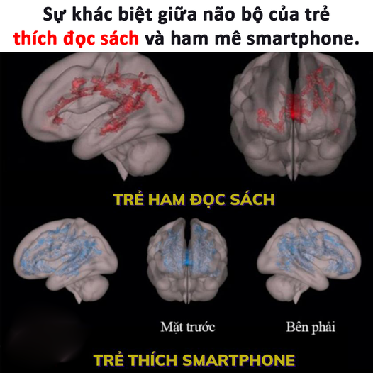 ẢNH CHỤP NÃO BỘ GIỮA TRẺ HAM ĐỌC SÁCH VỚI TRẺ THÍCH SMARTPHONE.
