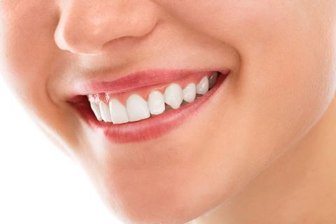 Nguyên nhân gây xỉn răng. Top 5 các sản phẩm tẩy trắng răng an toàn tại nhà