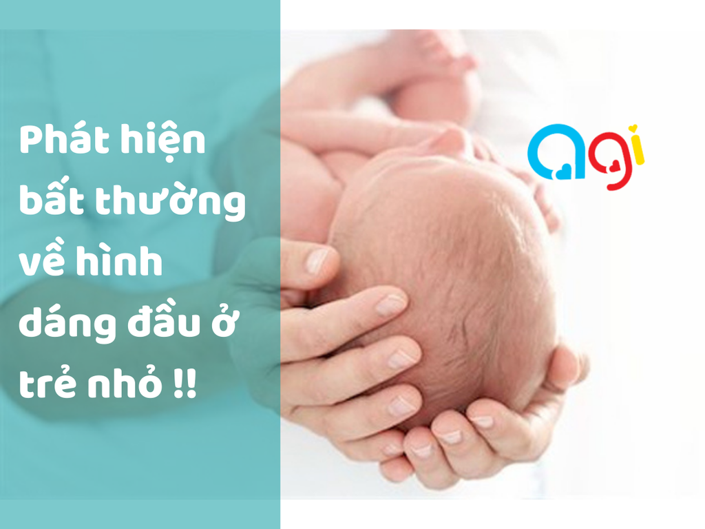 Phát hiện bất thường về hình dáng đầu ở trẻ nhỏ