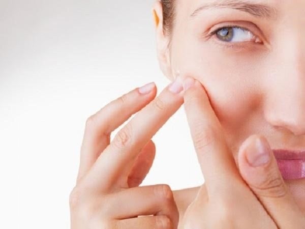 Do thói quen hay dùng tay sờ, nặn mụn khiến vi khuẩn bám dính vào da