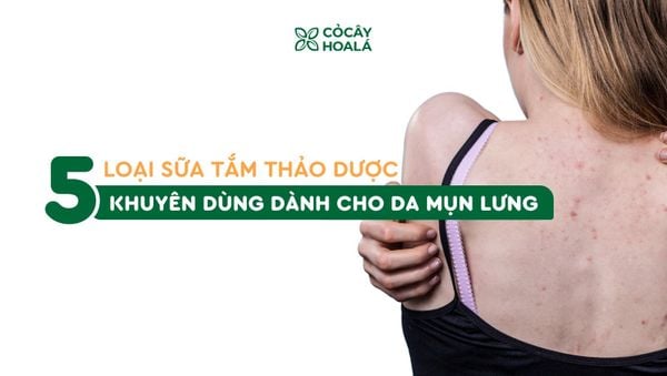 5 loại sữa tắm thảo dược được khuyên dùng cho da mụn lưng
