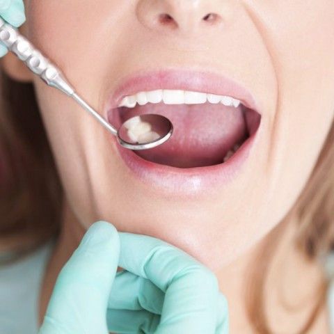 Top 5 bệnh lý răng miệng nguy hiểm mà người Việt Nam nào cũng mắc phải một lần trong đời
