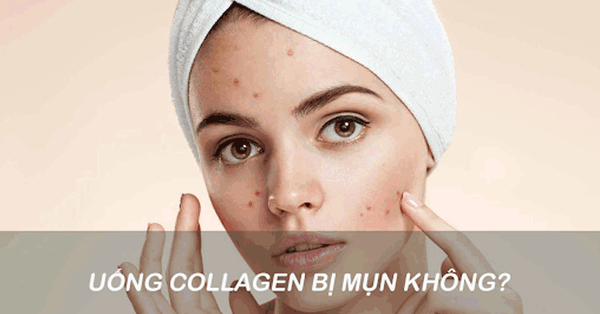 Da dầu có nên uống collagen không? Giải đáp chi tiết và khoa học