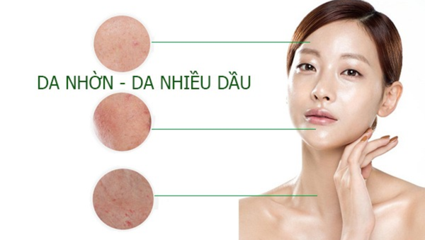 Những vấn đề thường gặp ở làn da dầu