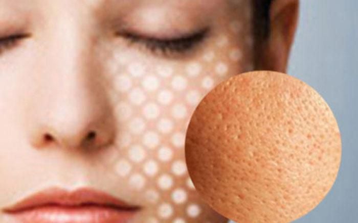Một số bí kíp làm se khít lỗ chân lông đơn giản tại nhà