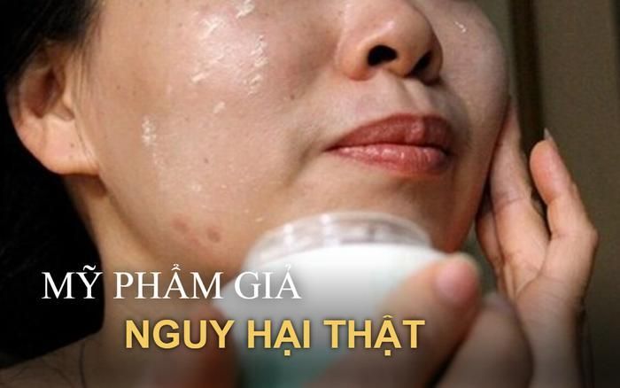 5 hệ lụy đáng sợ khi dùng mỹ phẩm kém chất lượng