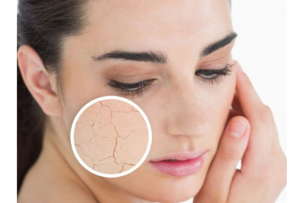 Sự Cần Thiết của Kem Dưỡng Ẩm Cho Da Mặt Trong Mùa Thu Đông