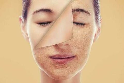 Hiểu và cách chống lão hóa da mặt
