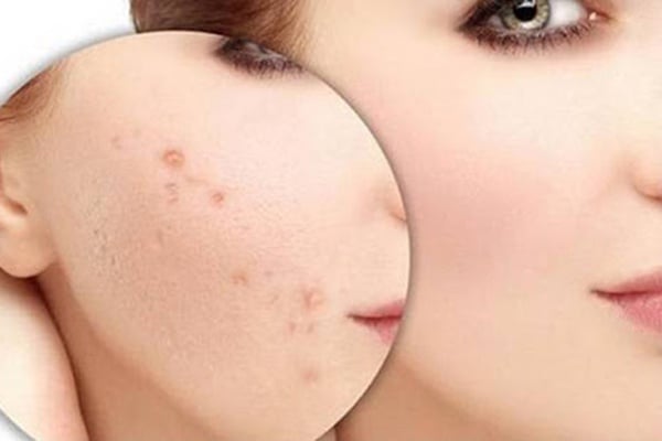 8 Cách giúp làm da trắng sáng khỏe khoắn ai cung nên biết