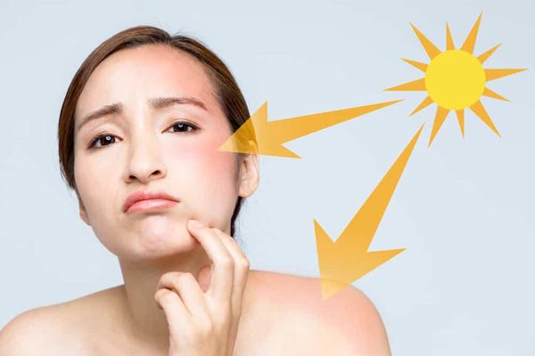 Bạn đã biết cách để làn da không bắt nắng?