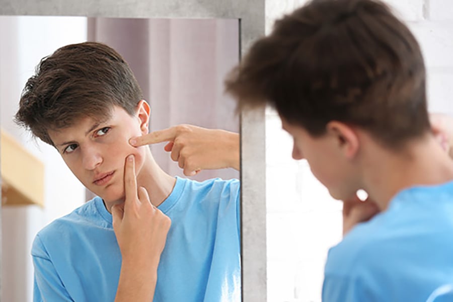 Top 10 serum trị mụn cho da dầu hiệu quả tốt nhất hiện nay