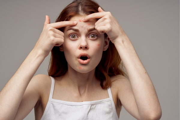 Hậu Quả Từ Việc Tự Nặn Mụn? Bạn Đã Biết Chưa?