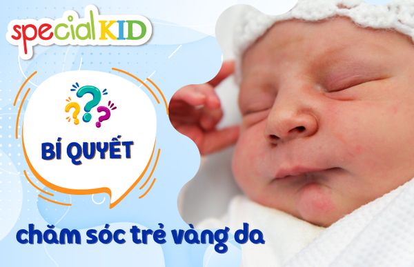 Bí quyết chăm sóc trẻ sơ sinh bị vàng da