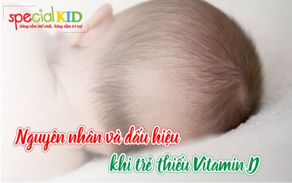 nguyên nhân và dấu hiệu khi trẻ thiếu vitamin D | Special Kid