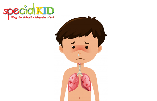 Viêm phổi | Special Kid