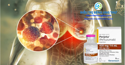 Giải Pháp Pertuzumab: Đột Phá Khoa Học Mới Giúp Nâng Cao Hiệu Quả Điều Trị Ung Thư Vú HER2