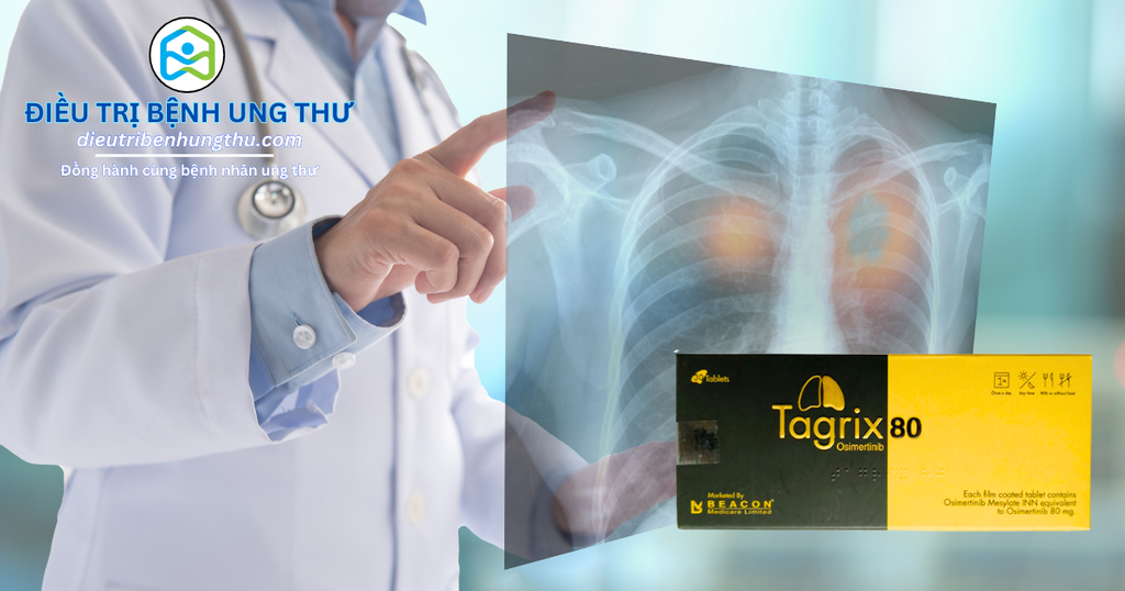 Tragrix Injection Tagrix (Osimertinib): Bước Đột Phá Quan Trọng Trong Điều Trị Ung Thư P ...