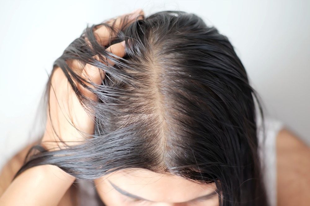 8 Cách chữa trị tóc dầu, tóc nhanh bết và mồ hôi dầu ở tóc hiệu quả |  Rungtoc.vn