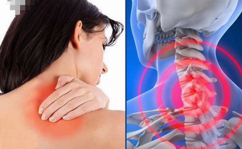 Vì Sao Giới Trẻ Ngày Nay Thường Đau Cổ Vai Gáy?