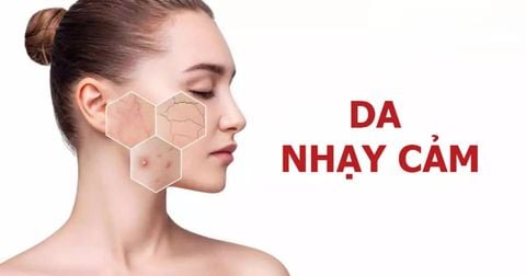 Da nhạy cảm – chống nắng sao cho an toàn mà vẫn hiệu quả?