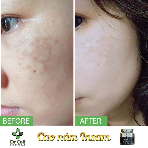 Cao nam Insam Dr Cell