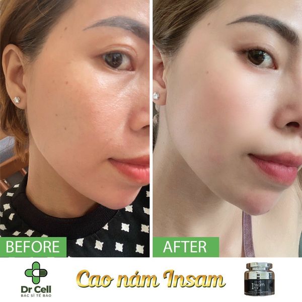 Cao nam Insam Dr Cell
