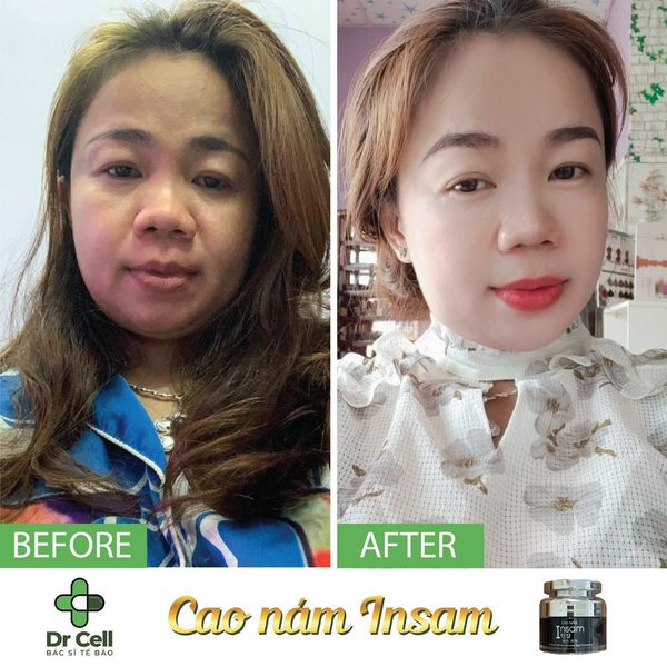 Cao nam Insam Dr Cell