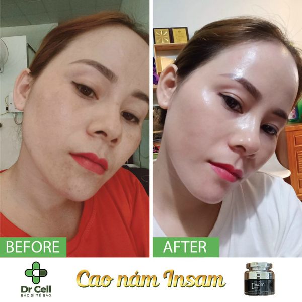 Cao nam Insam Dr Cell