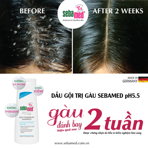 9 Biện Pháp Tại Nhà Để Loại Bỏ Gàu Một Cách Tự Nhiên