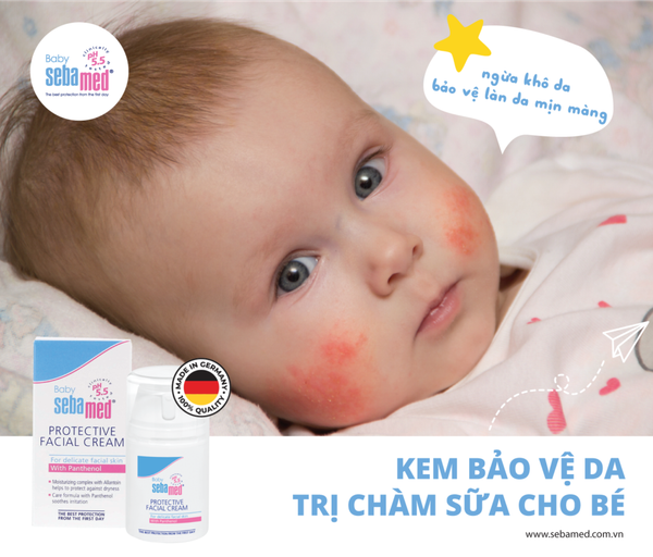 Kem bảo vệ da, trị chàm sữa cho bé Sebamed pH5.5
