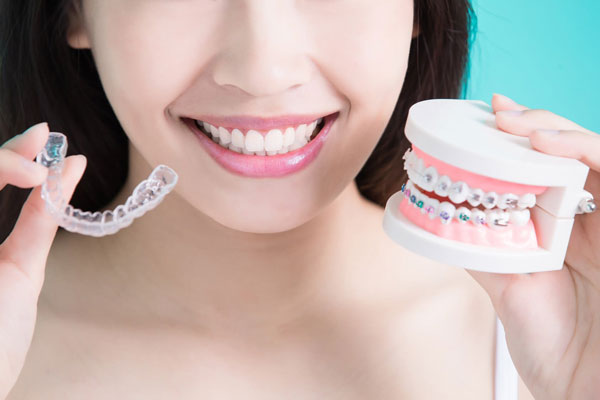 Các phương pháp niềng răng hô phổ biến, hiệu quả cao